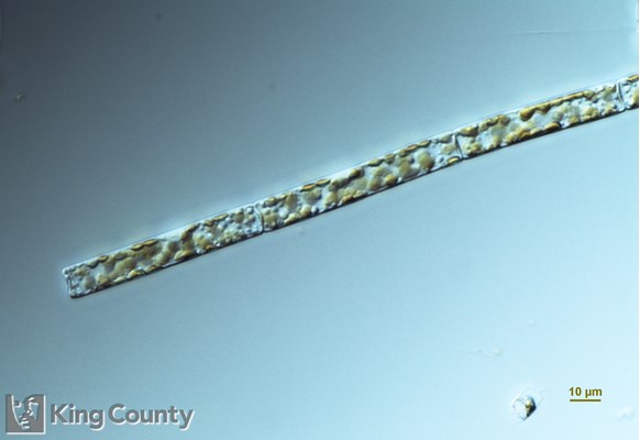 Photo of Leptocylindrus danicus